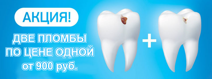 Две пломбы по цене одной!