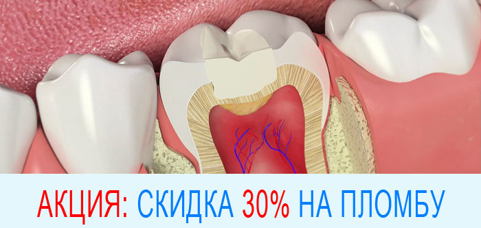  30%   