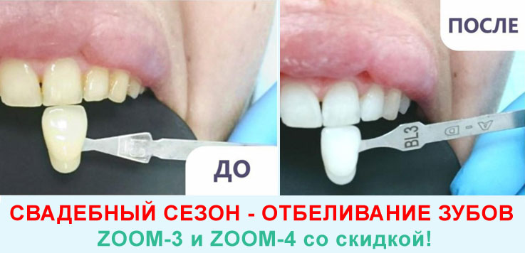    ZOOM-3  ZOOM-4