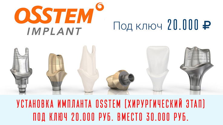 Импланты Osstem Томск Октябрьский Взвоз Исправление прикуса у детей Томск Корейский